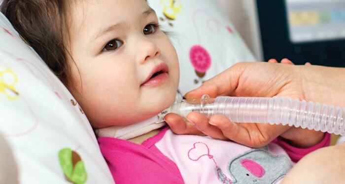 Airway Clearance Devices