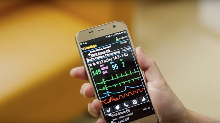 Uso de dispositivos móviles para gestionar alarmas de supervisión con vídeo Philips CareEvent