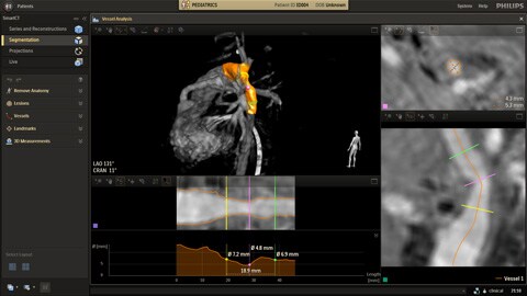 Flujo de trabajo de radiología flexible