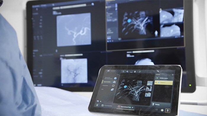 Imagenología 3D de SmartCT