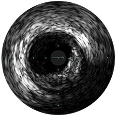 figital ivus eeg