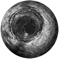 rotational- vus hi q level2