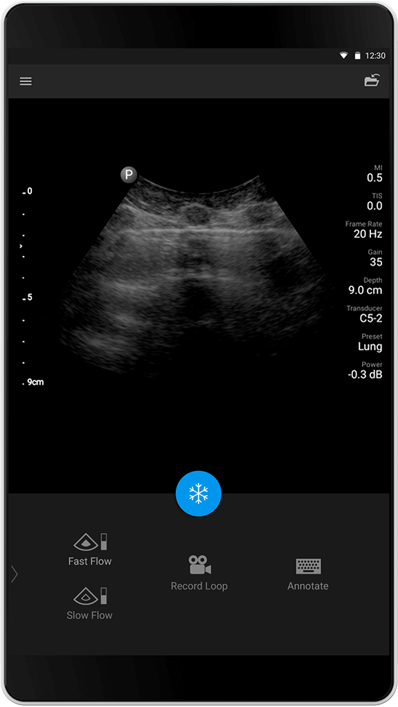 Estudio pulmonar C5-2