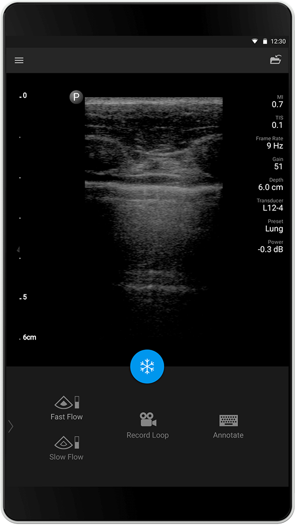 Estudio pulmonar