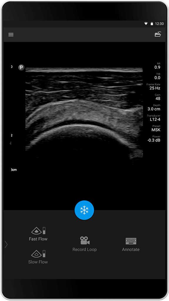 Estudio pulmonar