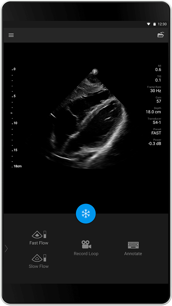 Estudio FAST S4-1