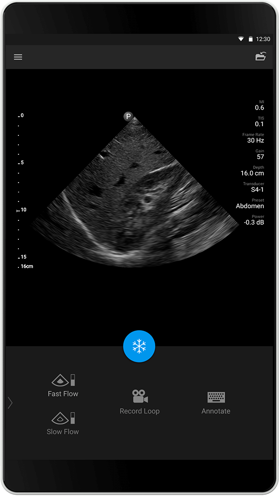 Estudio abdominal, S4-1