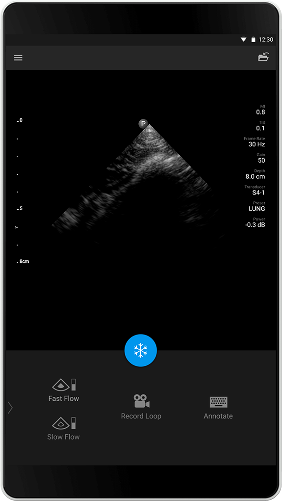 Estudio pulmonar S4-1
