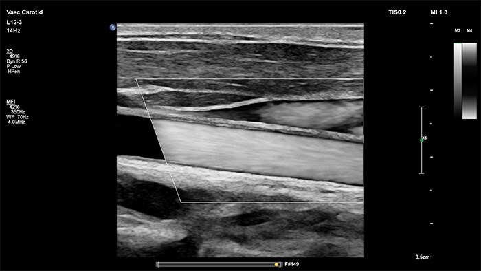 Ultrasonidos de alta resolución