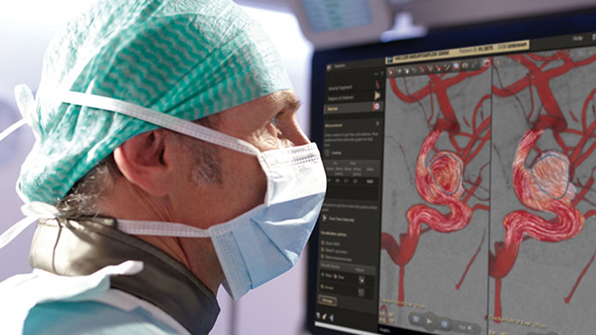 Jornada de Concientización por el Día Mundial Contra el Ataque Cerebro-Vascular (ACV)