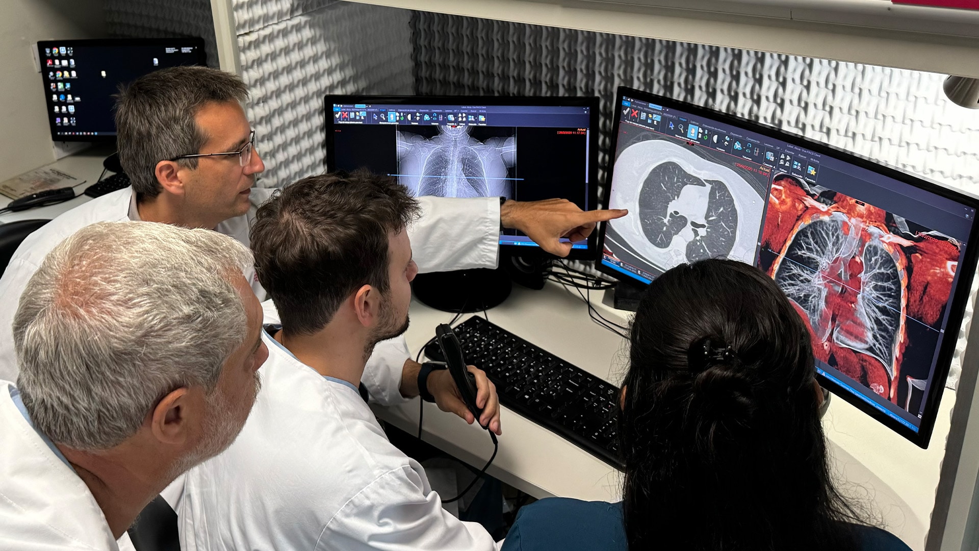 La Fundación Philips y la Fundación FUCA lideran una iniciativa de telerradiología para la detección temprana del cáncer de pulmón en regiones remotas de Argentina