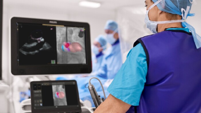 Philips incluye la IA en sus soluciones de salud para ofrecer mejores cuidados a más personas