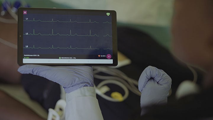 El papel decisivo de la ecografía móvil para mejorar la atención cardíaca en entornos desatendidos